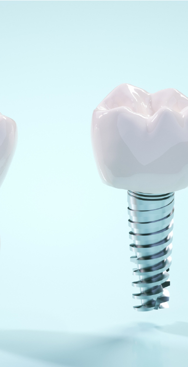 欠損歯の治療の選択肢