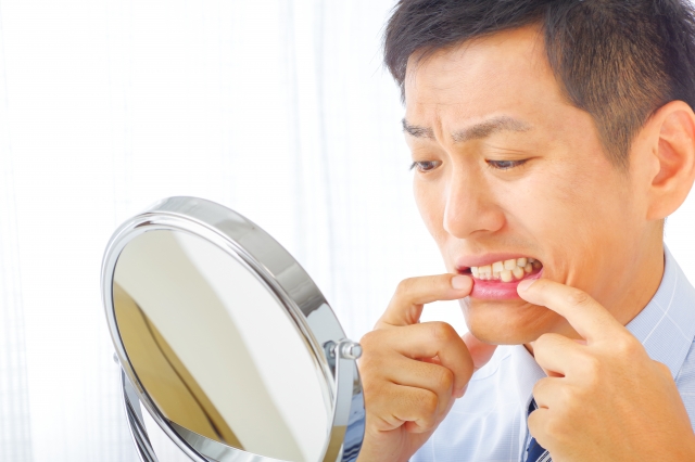 叢生・乱ぐい歯とは?