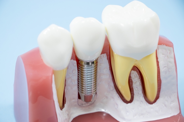 サイナスリフト