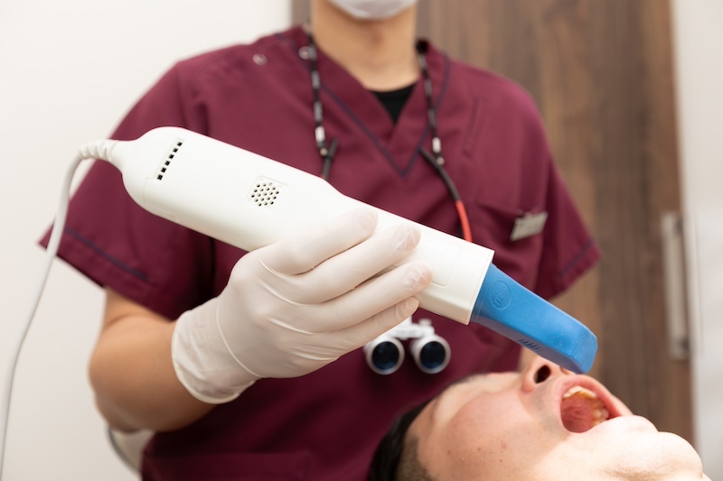 iTero(光学スキャナー)を導入